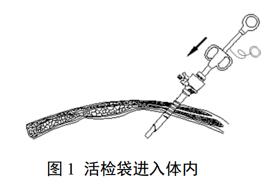 一次性使用内窥镜用活检袋注册审查指导原则（2025年最新版）(图1)