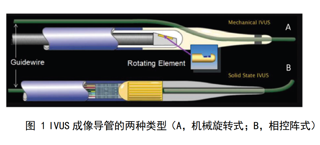 血管内超声诊断设备注册审查指导原则（征求意见稿）-2025年最新版(图1)