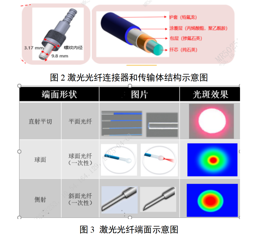 泌尿系统激光治疗设备注册审查指导原则(征求意见稿)(图2) 泌尿系统激光治疗设备注册审查指导原则(征求意见稿)(图2)