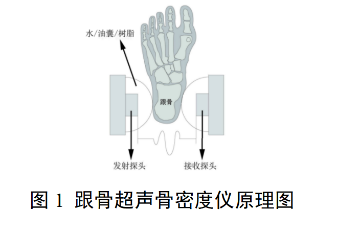超声骨密度仪注册审查指导原则（2025年修订版）