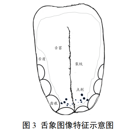 中医舌诊仪产品注册审查指导原则(2026年最新版)(图3) 中医舌诊仪产品注册审查指导原则(2026年最新版)(图3)