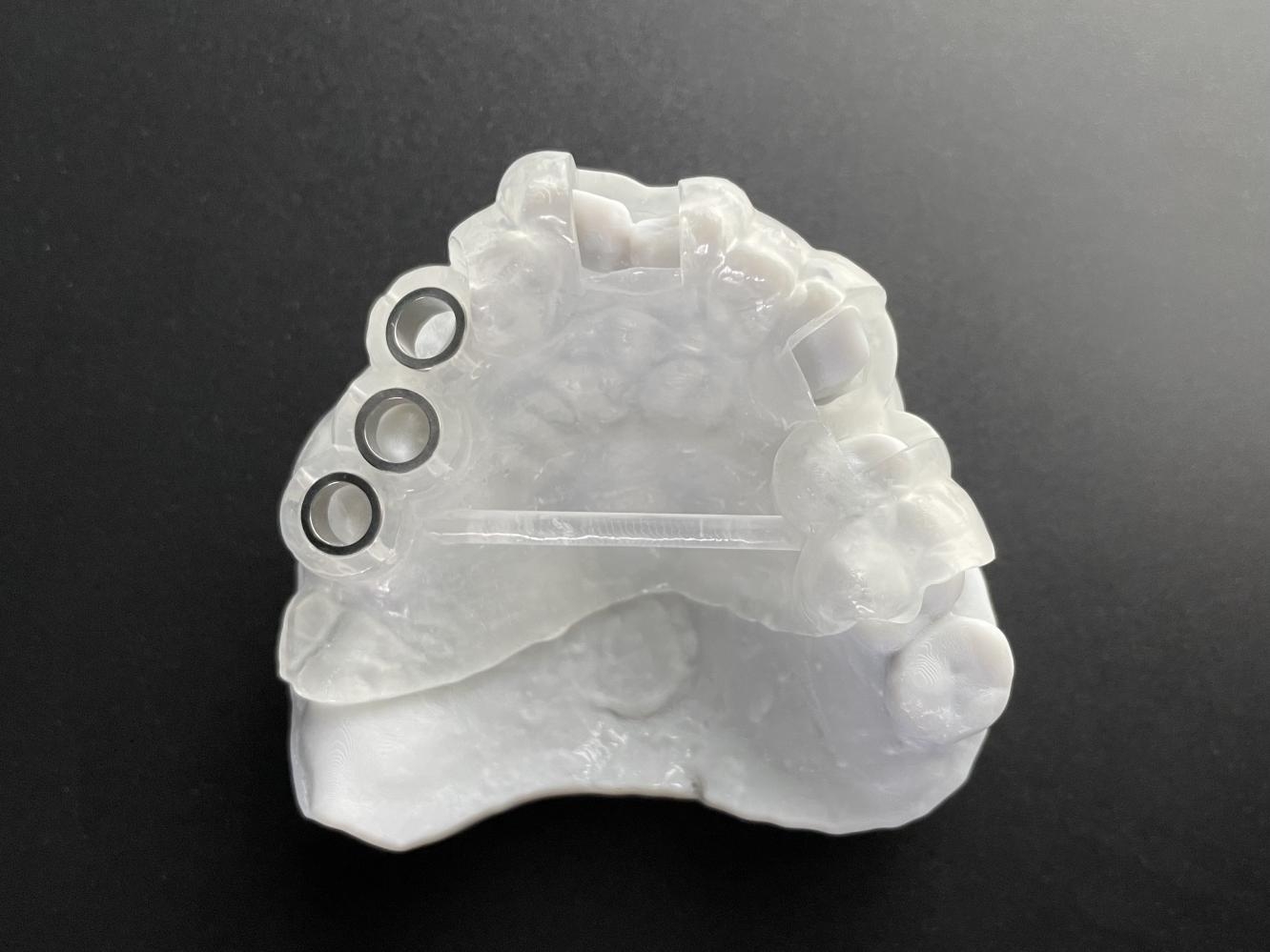 牙科种植用导板注册审查指导原则(2026年最新版)(图4) 牙科种植用导板注册审查指导原则(2026年最新版)(图4)